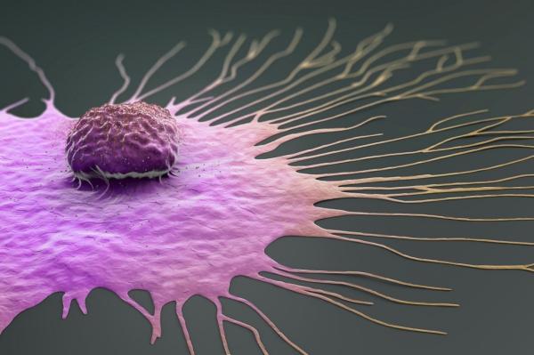توسعه یک الگوریم که شایع ترین سرطان مرد ها پیش بینی می نماید!